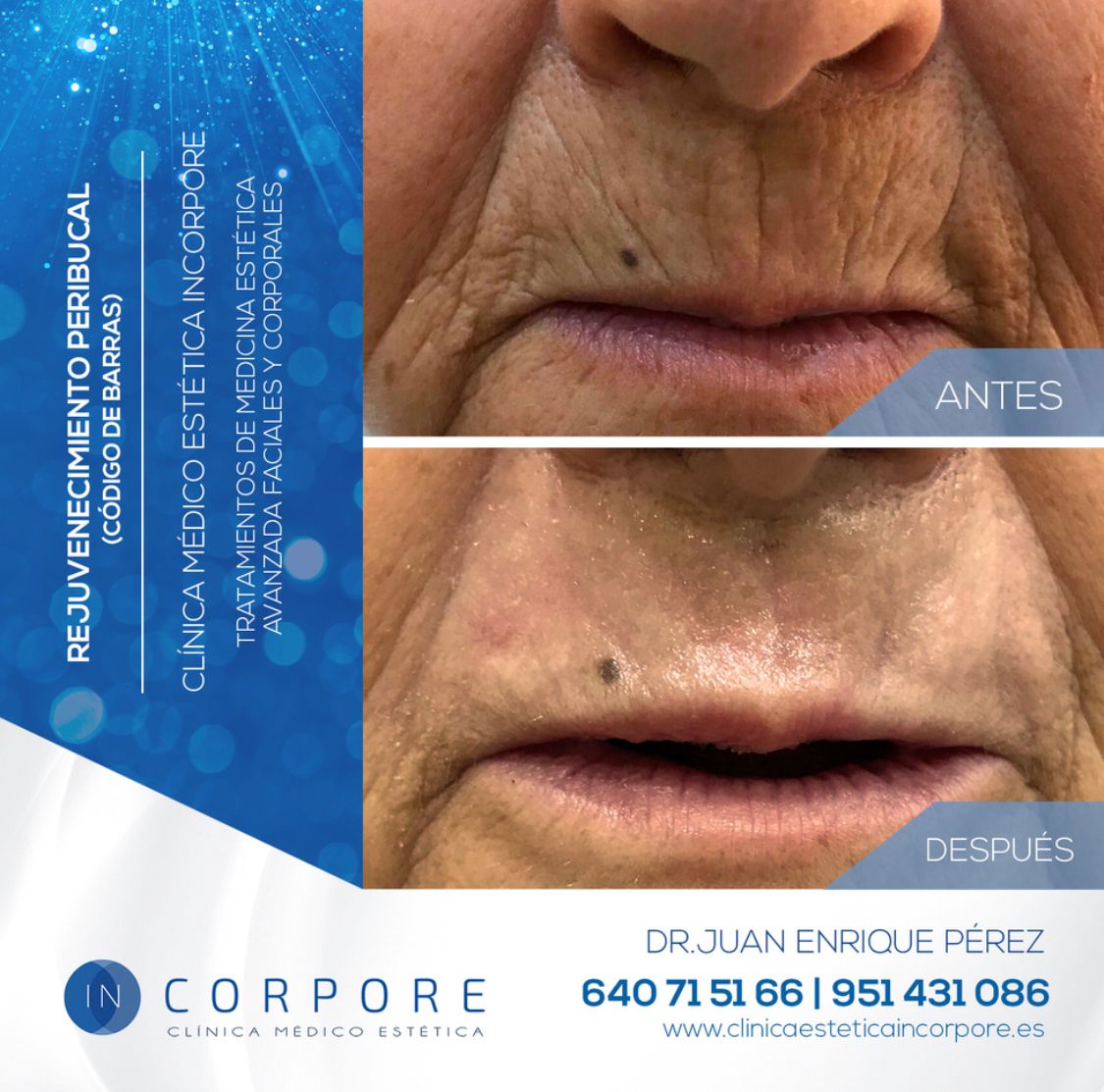 Juan Enrique Pérez Enríquez-124