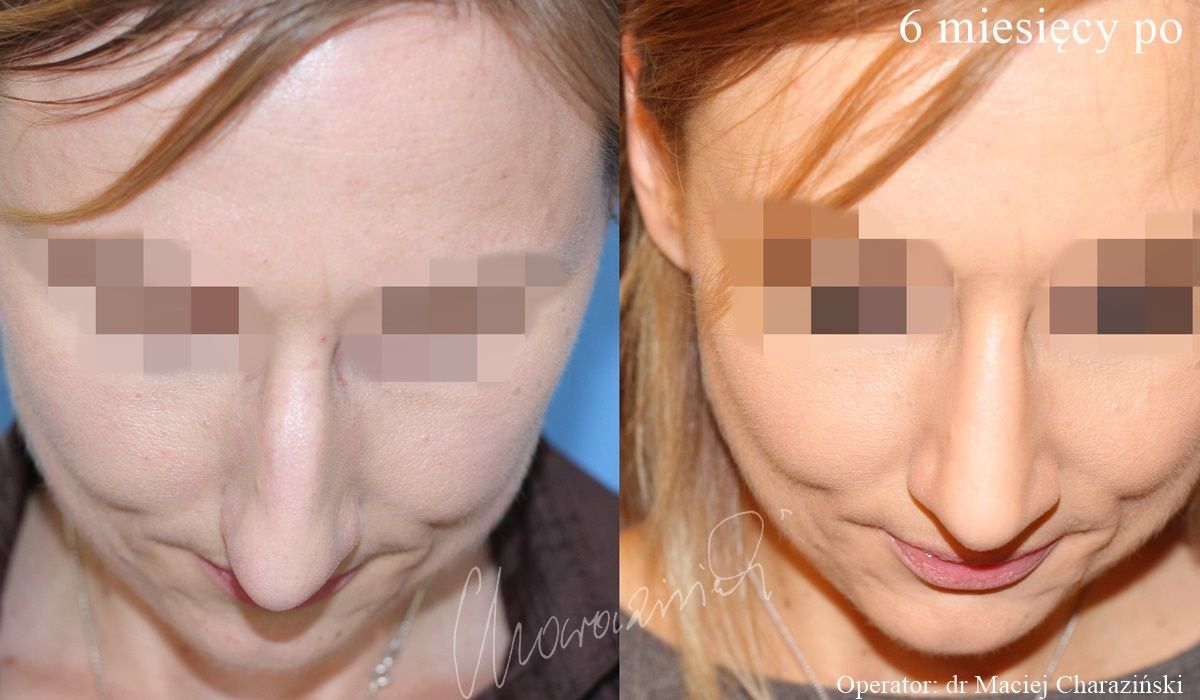 Maciej Charaziński-15