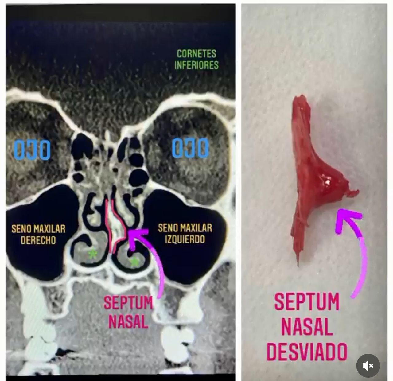Ermidelia Candelaria Martin Lorenzo-17