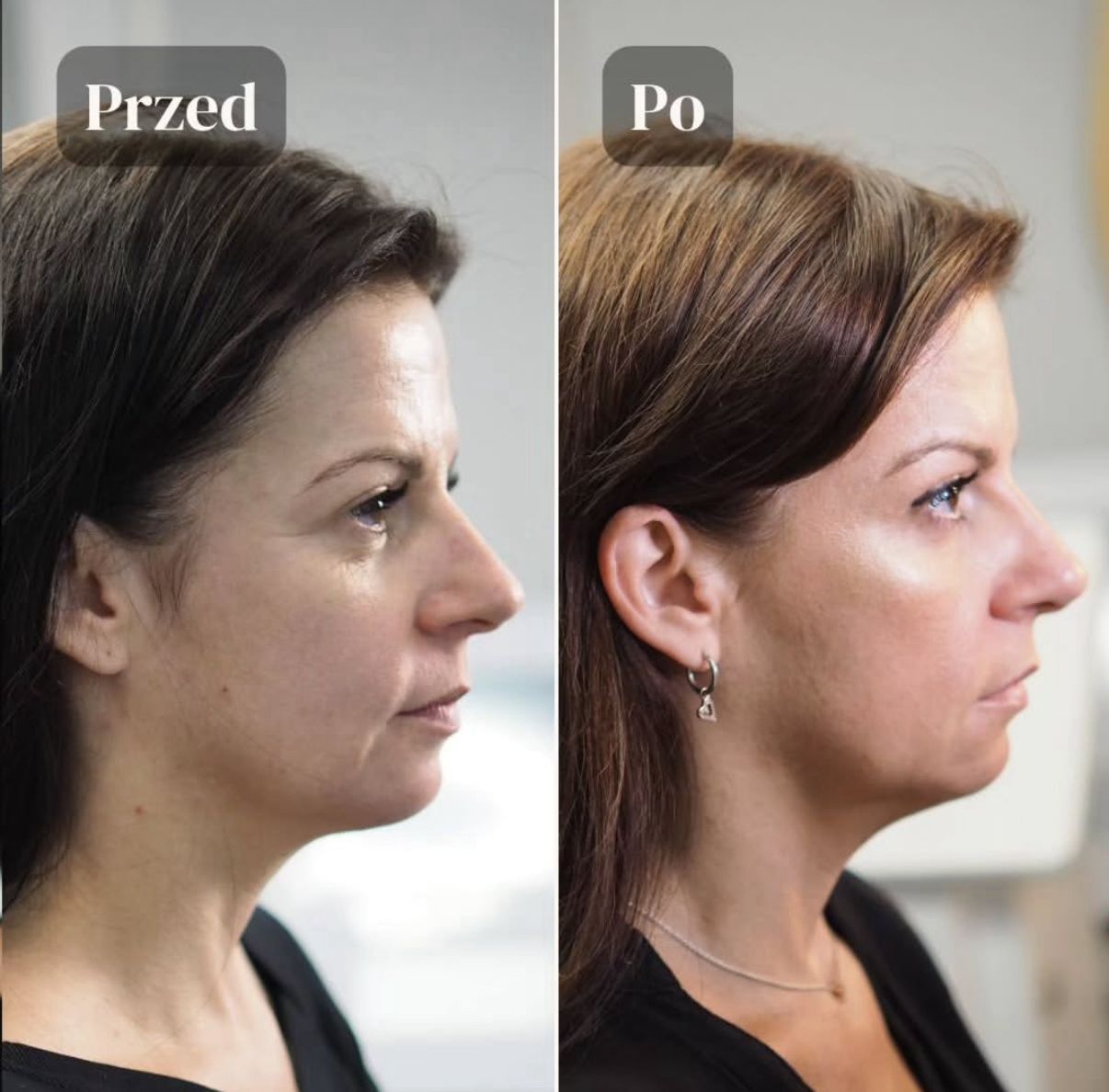 Aleksandra Kowalczuk-7