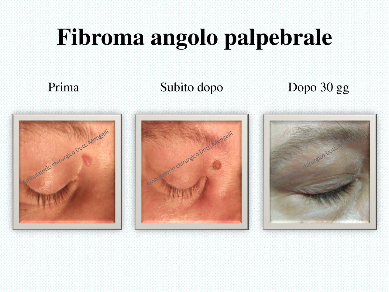 Matteo Antonio Mongelli-15