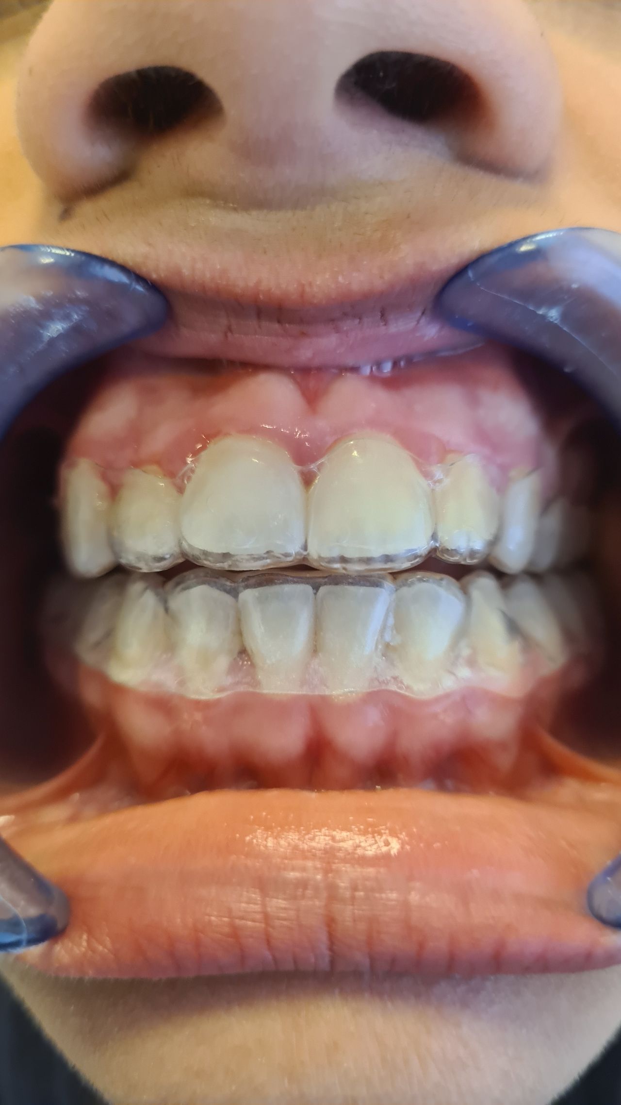 Federica Ingallina-7