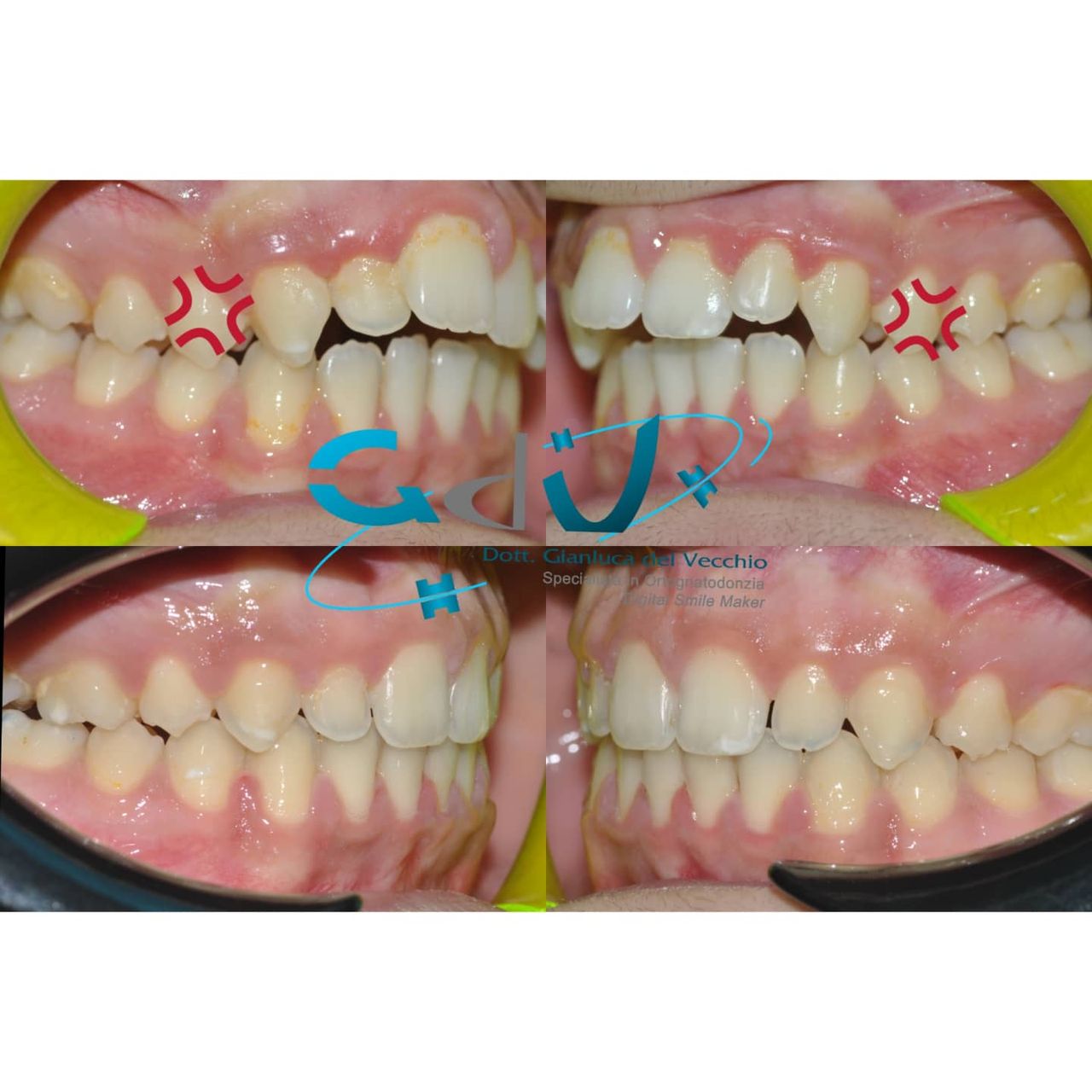 Gianluca Del Vecchio-162