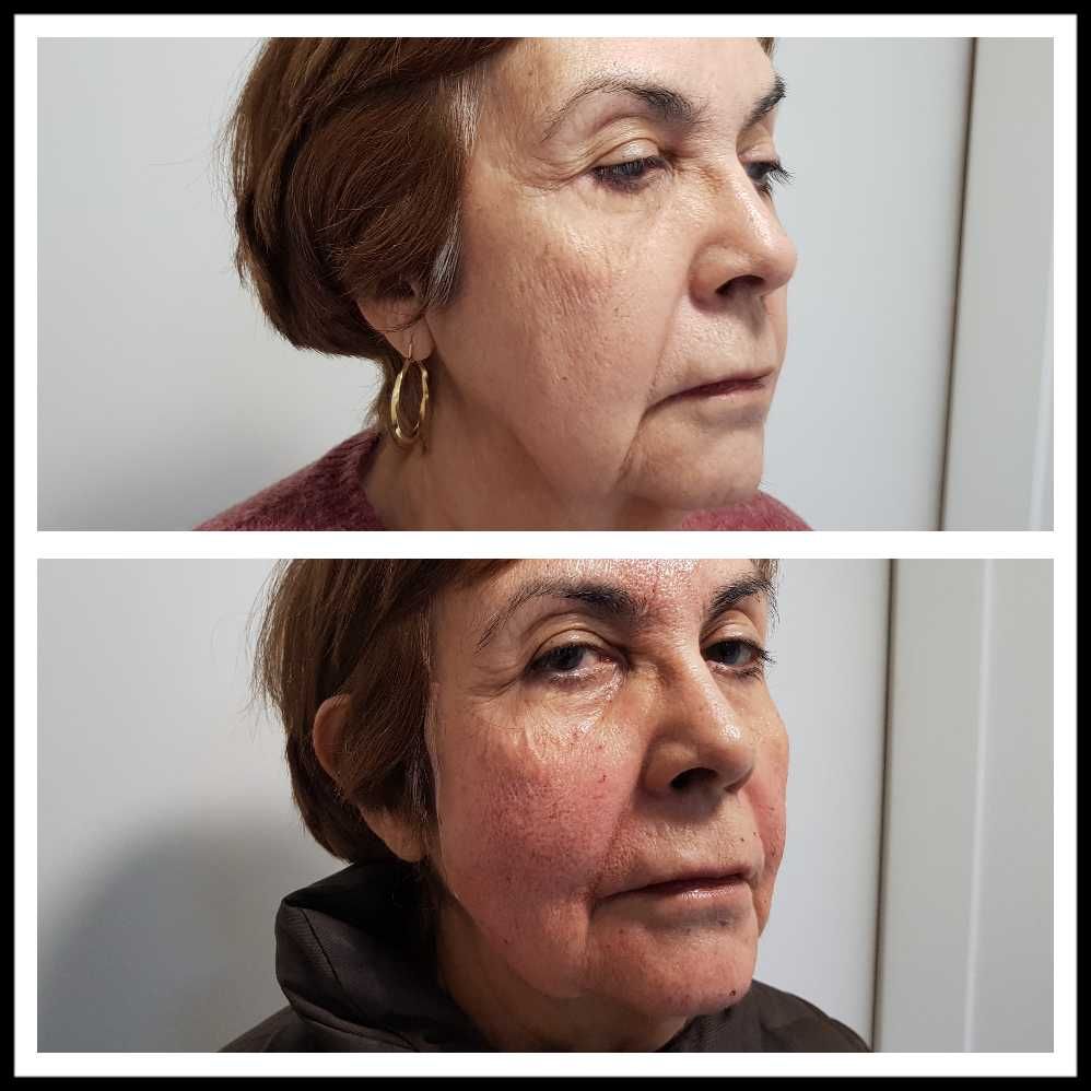 Rosalba Herrero Zerpa-412