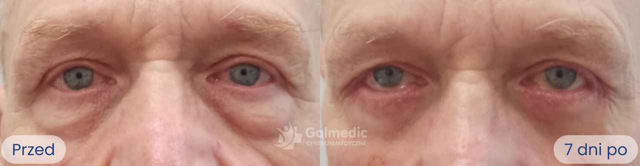 Aneta Michalik-Jakubek-7