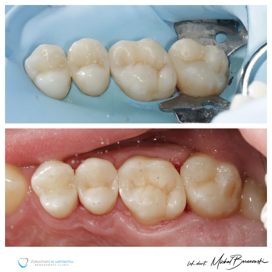 Michał Berezowski-41