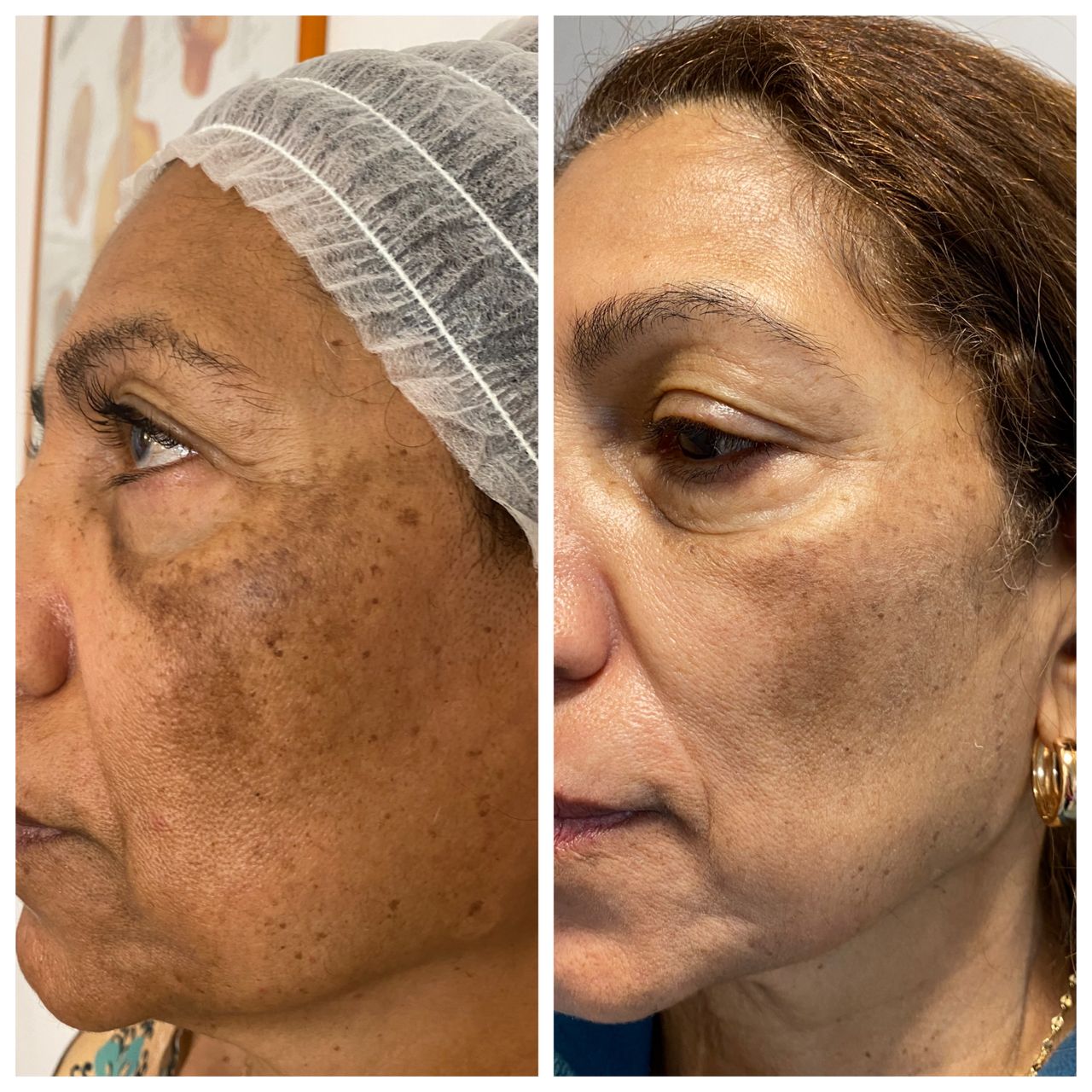 Elisabetta Fabiani-66