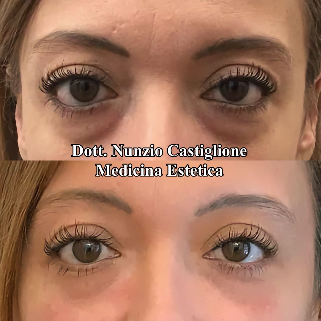 Nunzio Castiglione-5