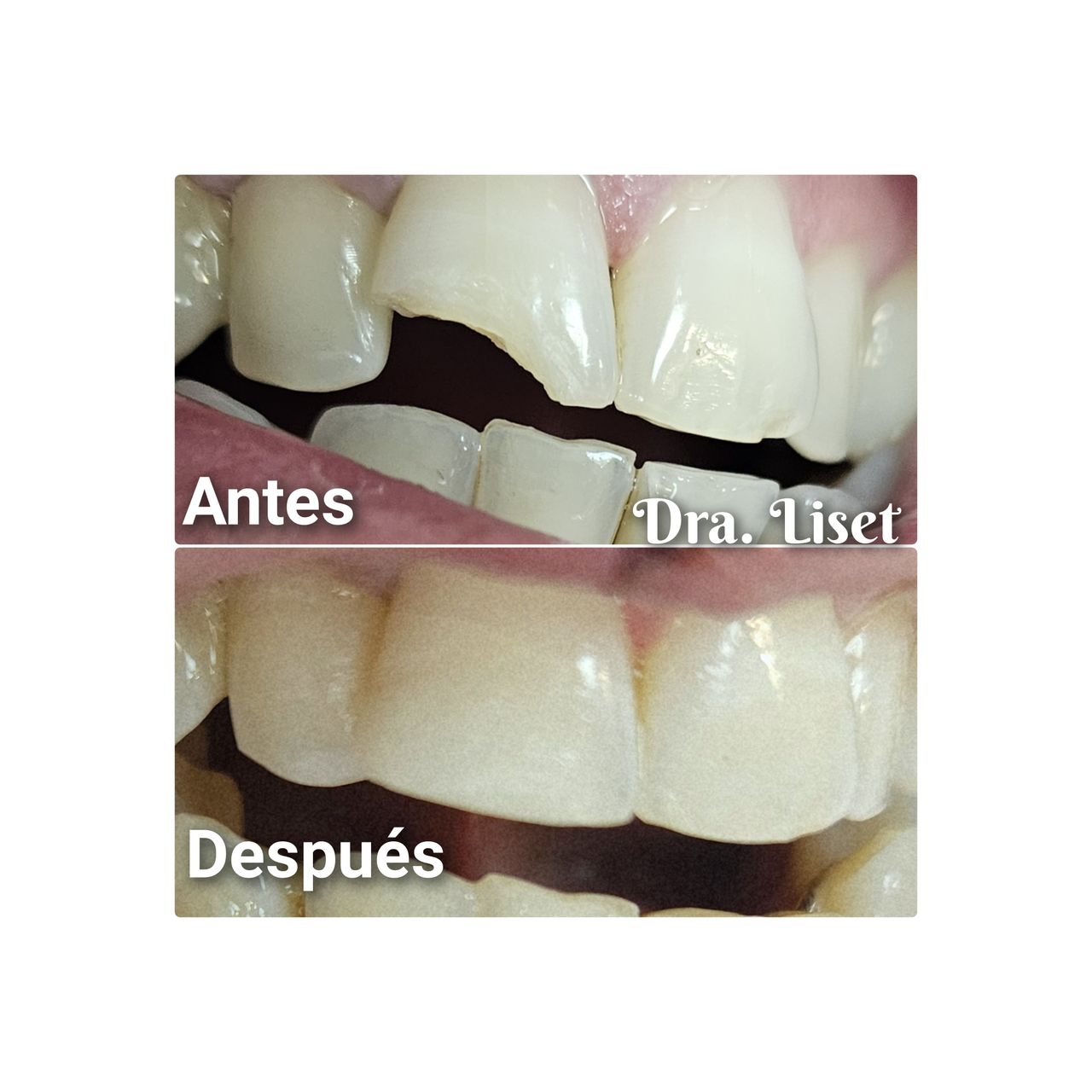 Liset Sánchez De Hombre-8