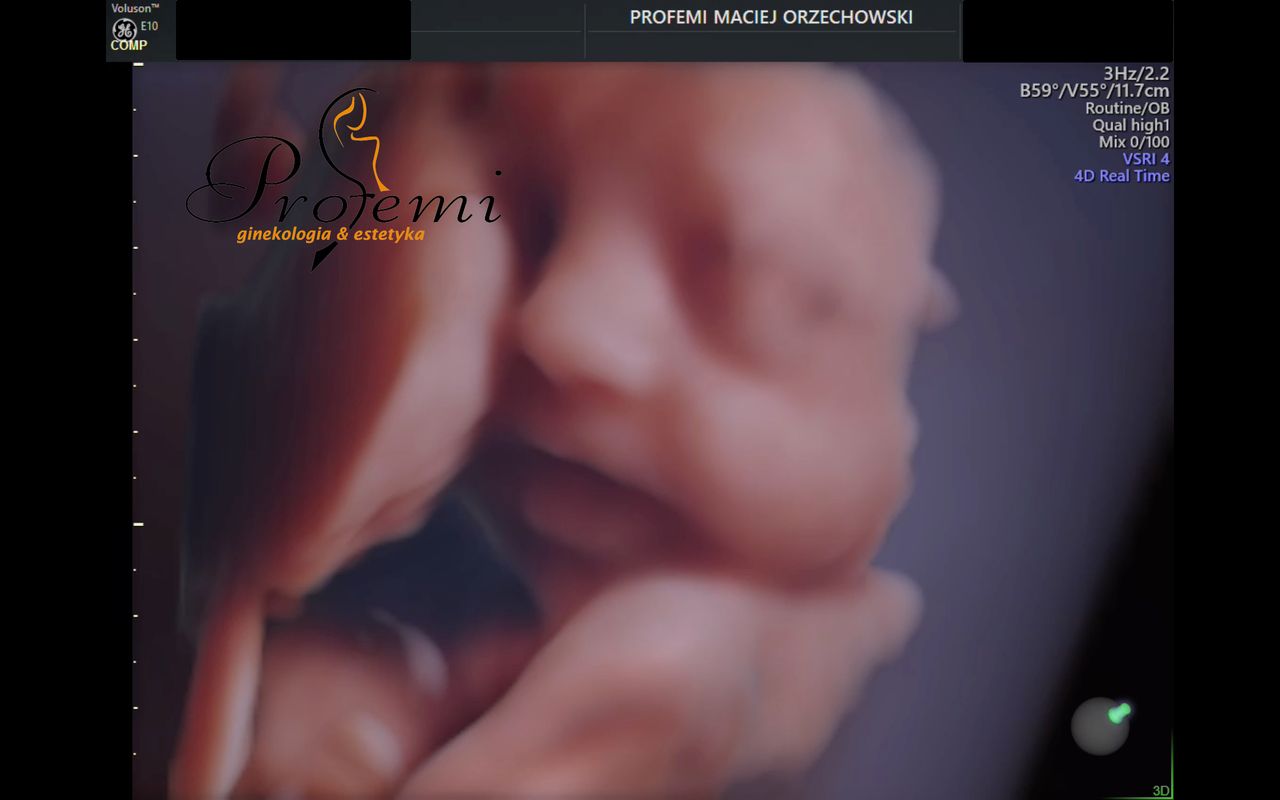 Maciej Orzechowski-21