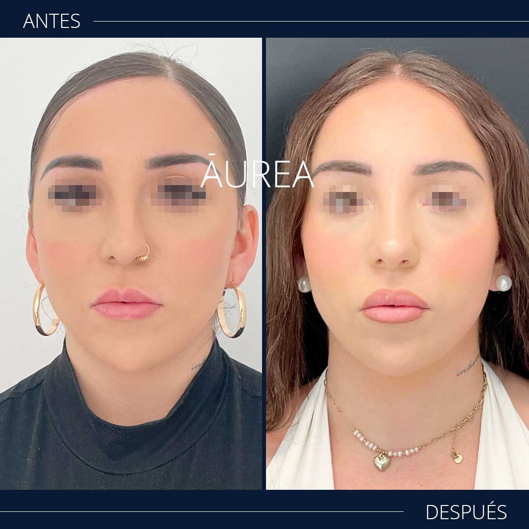 Ana Martínez Padilla-0
