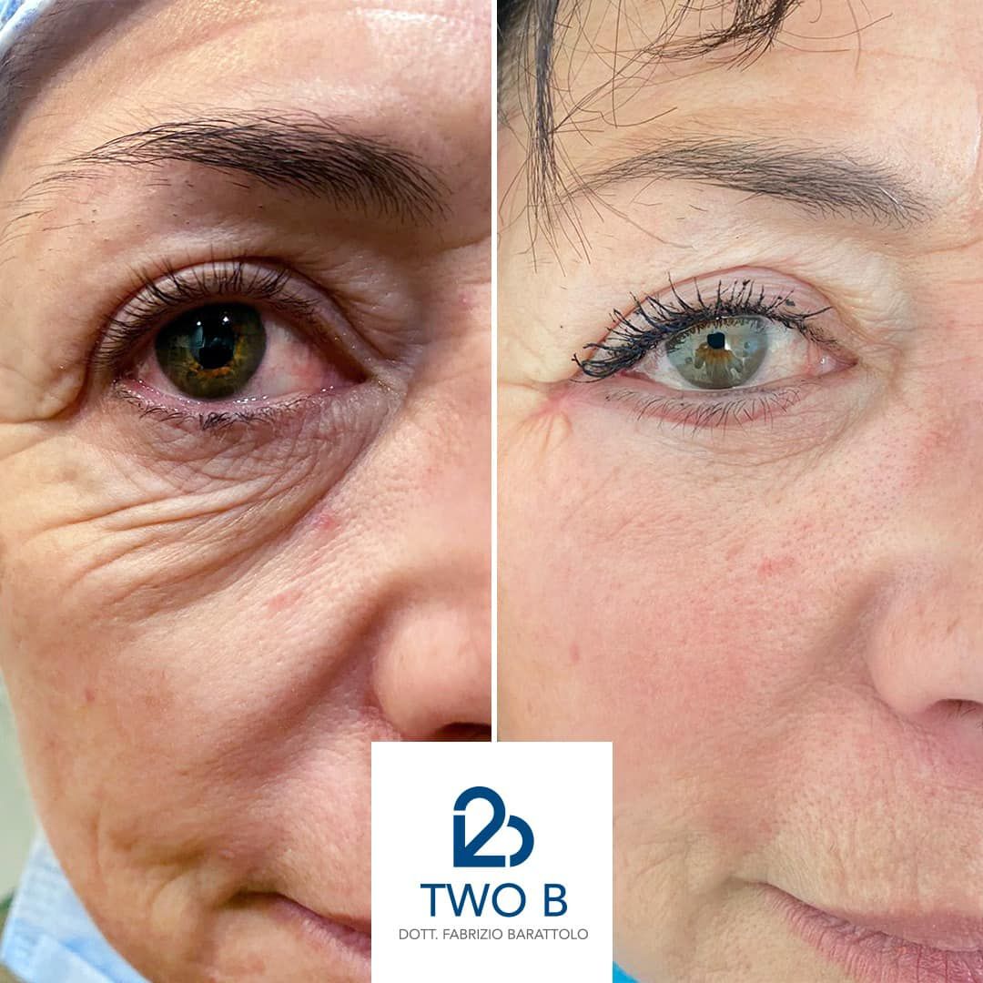 Fabrizio Barattolo-3