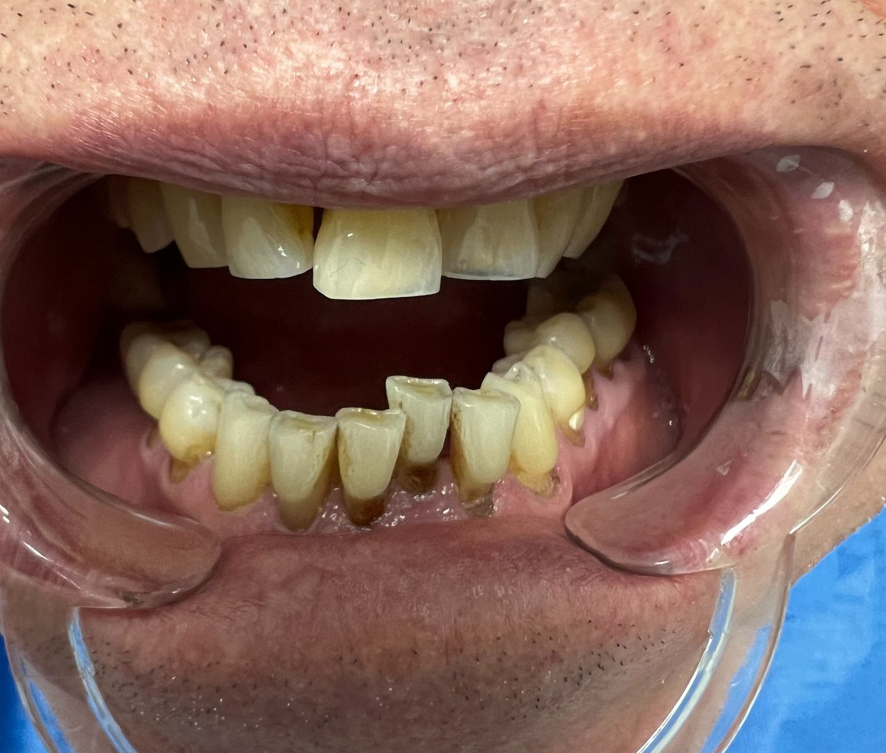 Luigi Aiardo Esposito-13