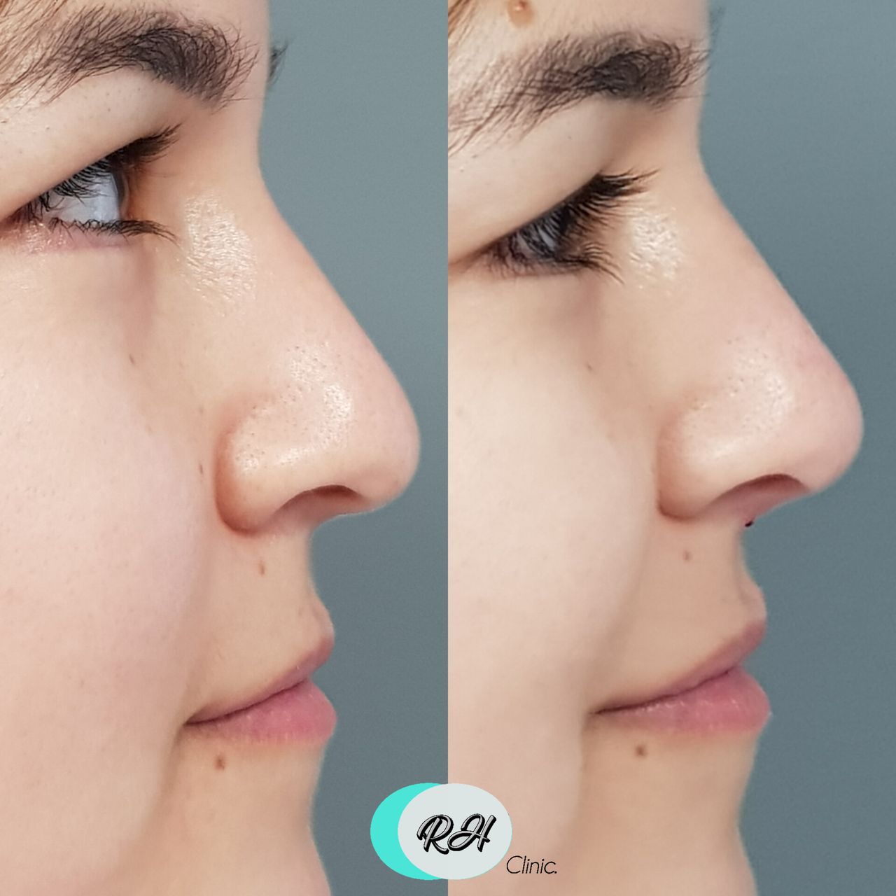 Rosalba Herrero Zerpa-590