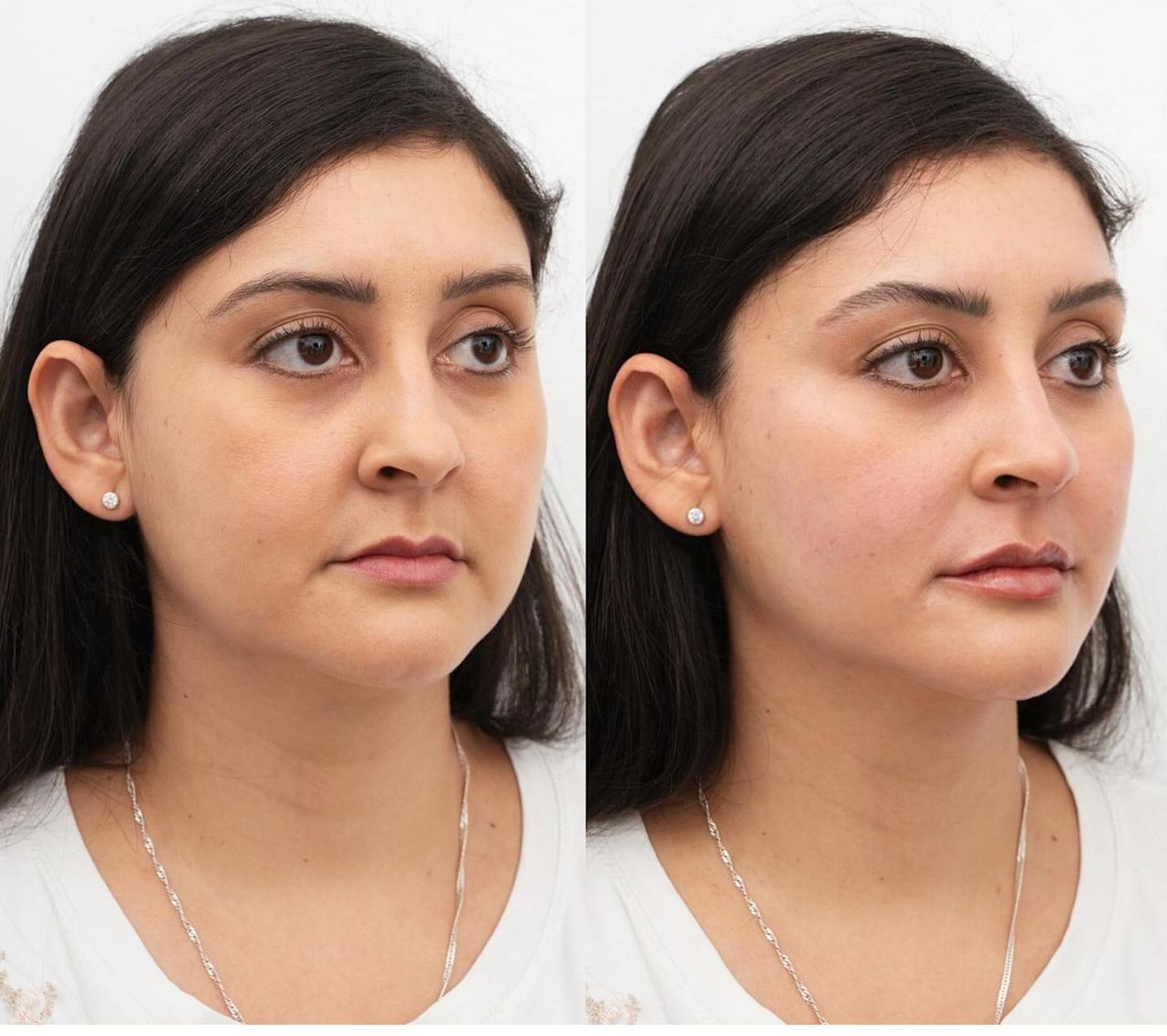 Raquel Moreno Pentinel-71