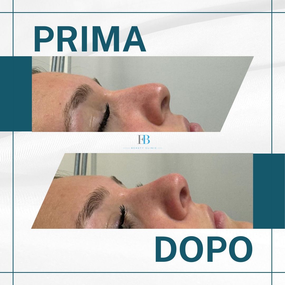 Francesco Bellucci-3