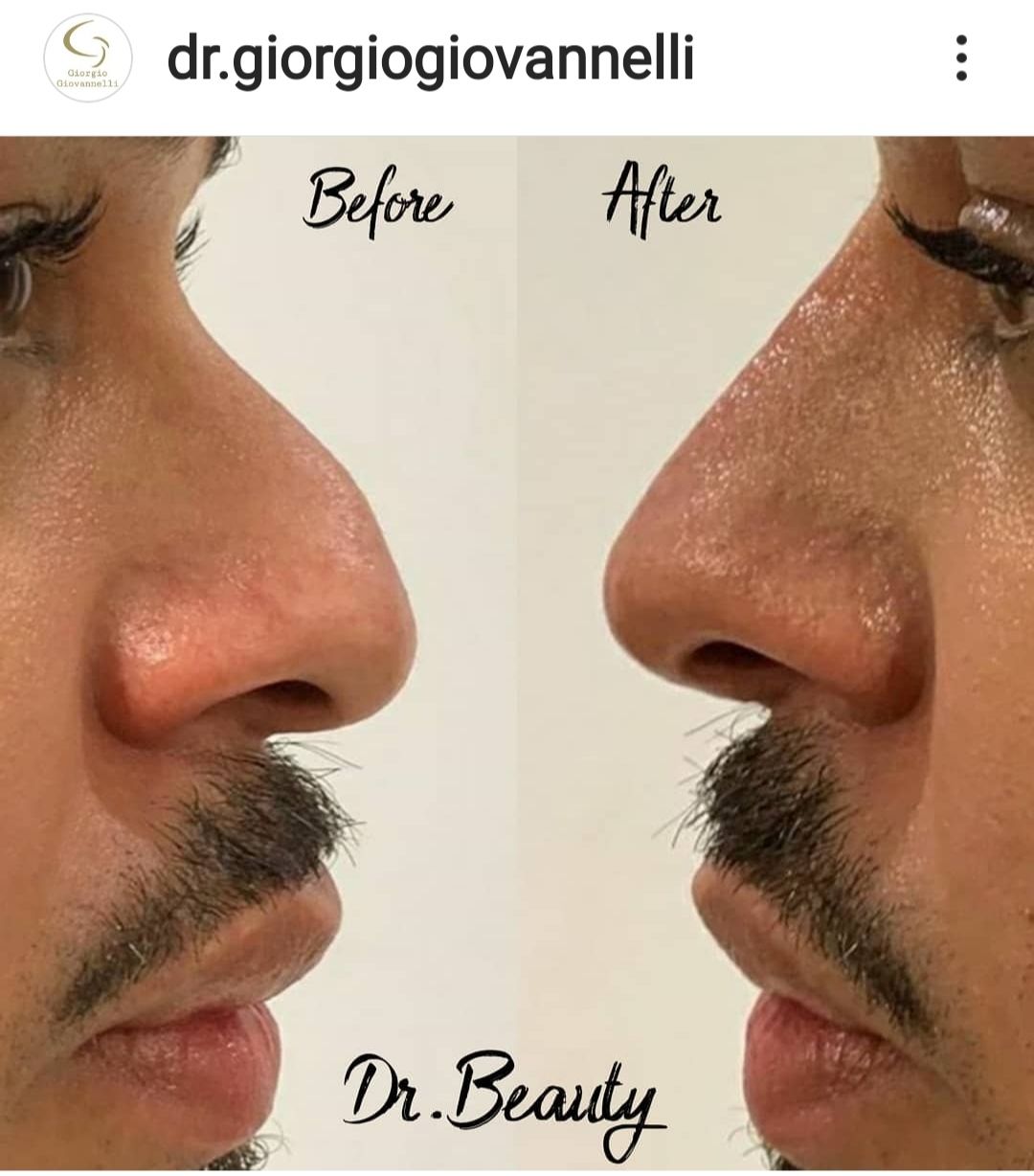 Giorgio Giovannelli-33