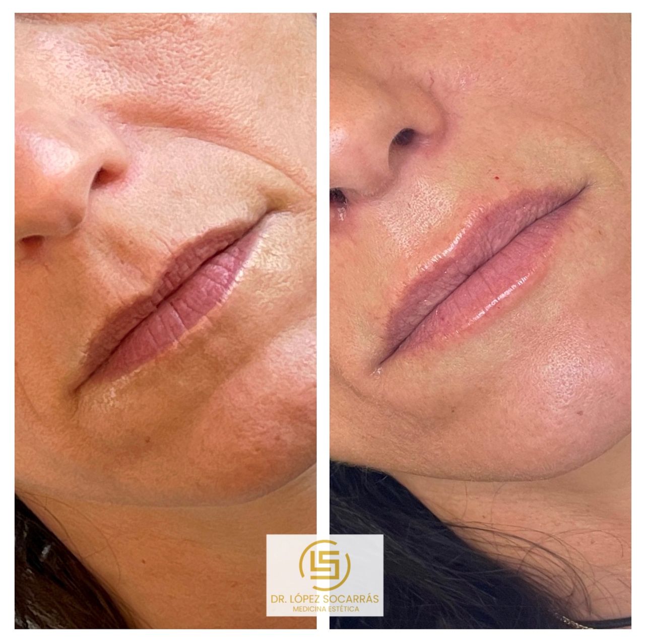 Camilo López Socarrás-4