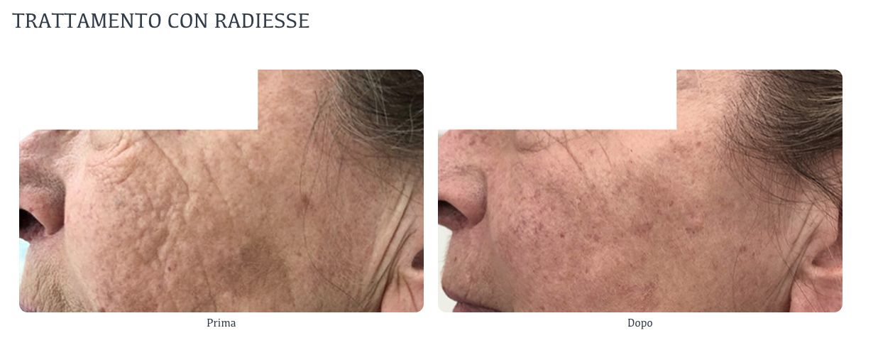 Susanne Innocenti-10