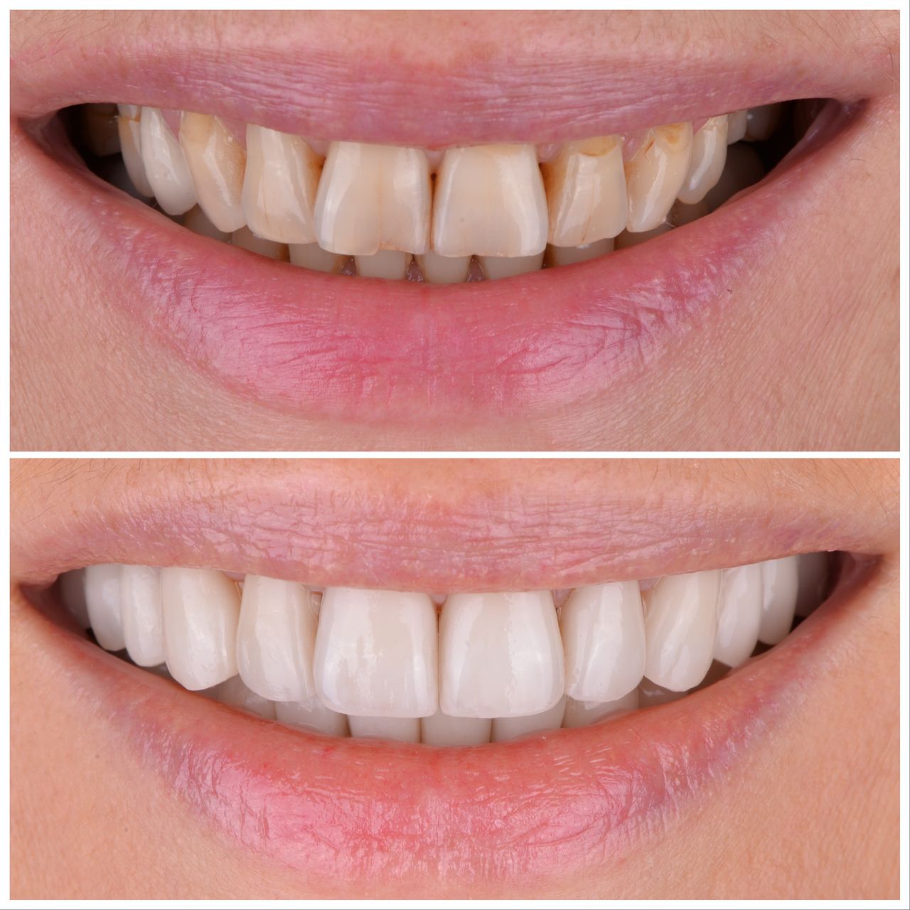 Martin Bartoszcze-16