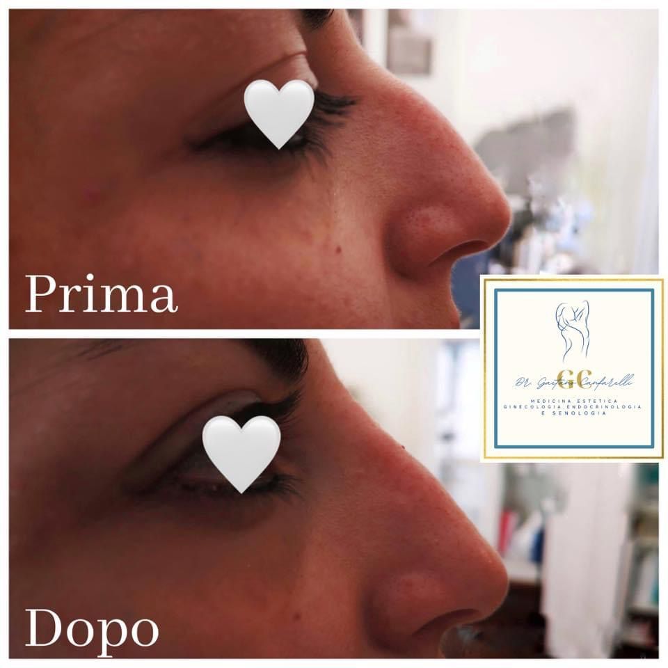 Gaetano Salvatore Canfarelli-6