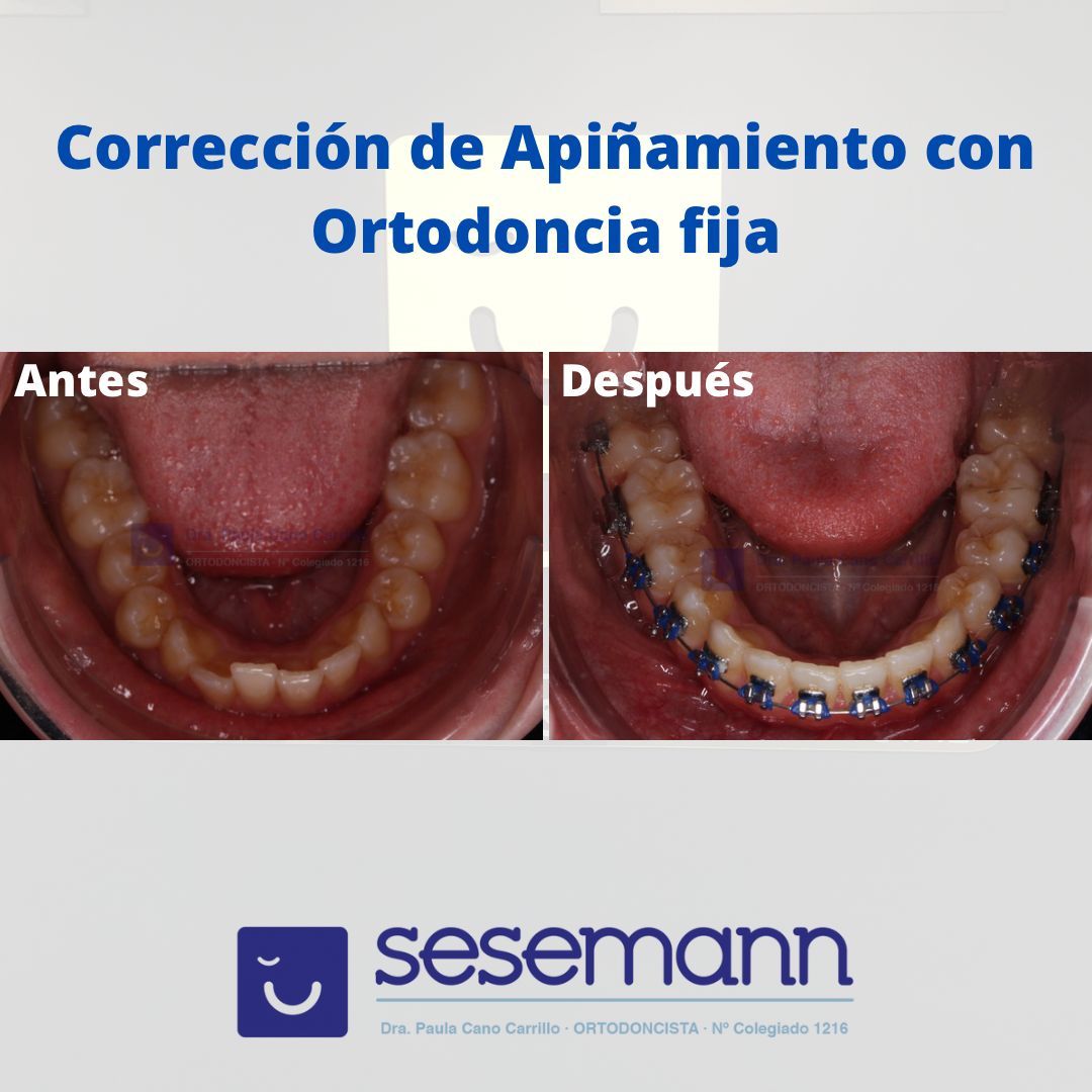 Paula Cano Carrillo-22