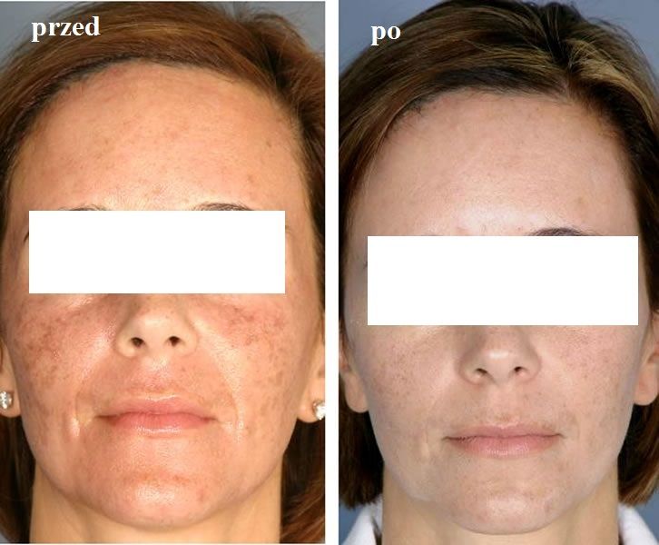 Zbigniew Pietrzak-10