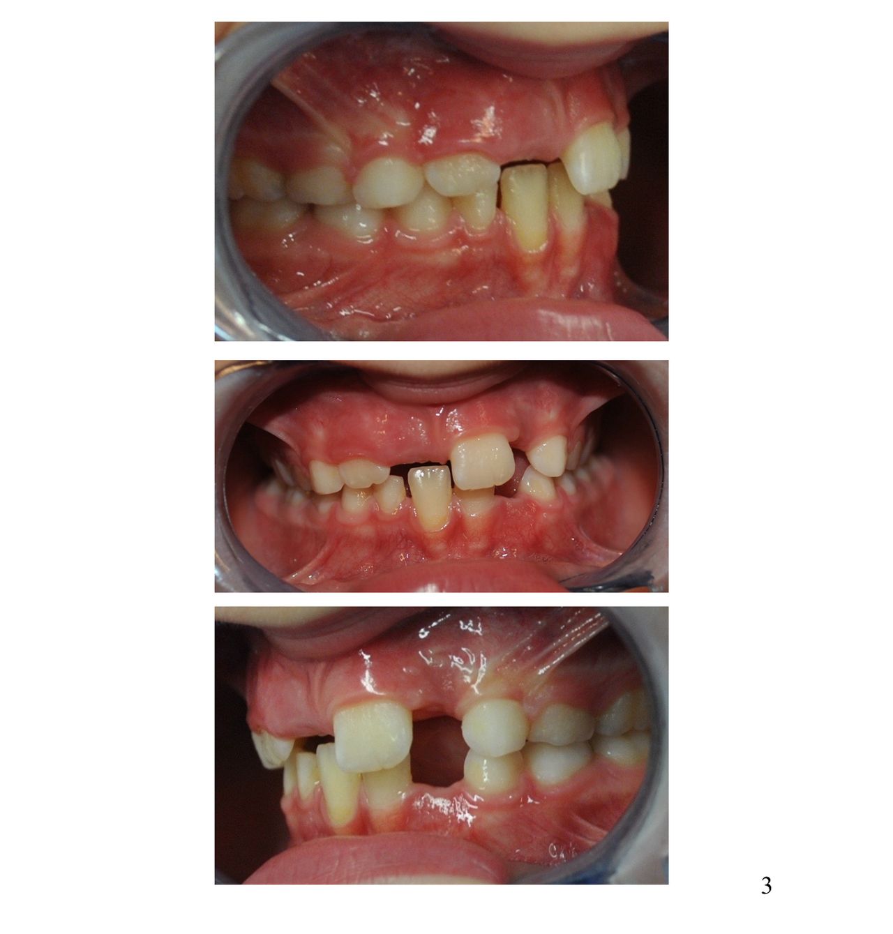 Giacinto Daniele Fiorenza-16