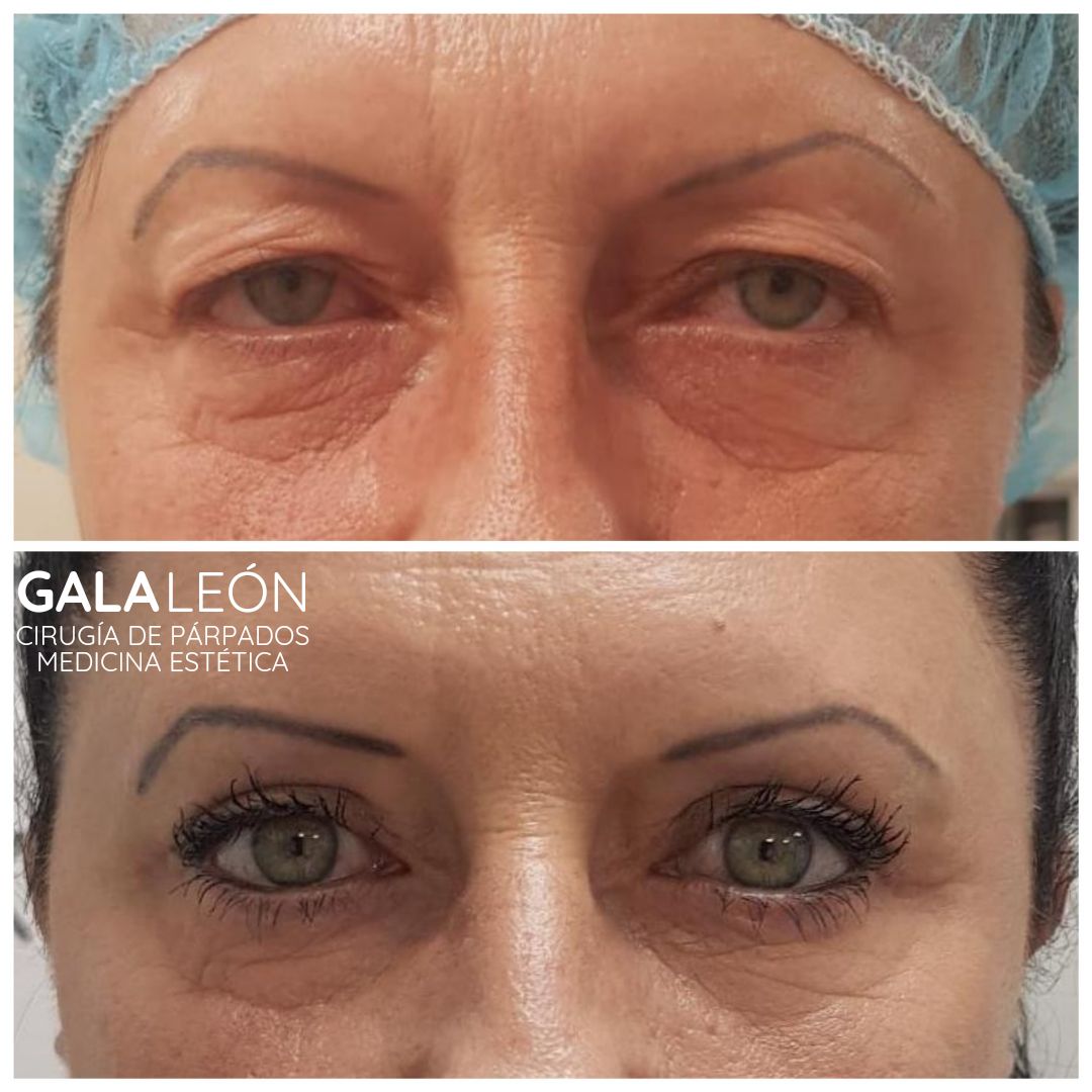 Gala P. Leon Salvatierra-33