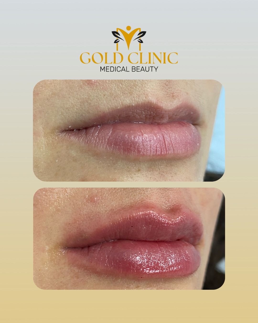 Giuseppe Ferrucci-11