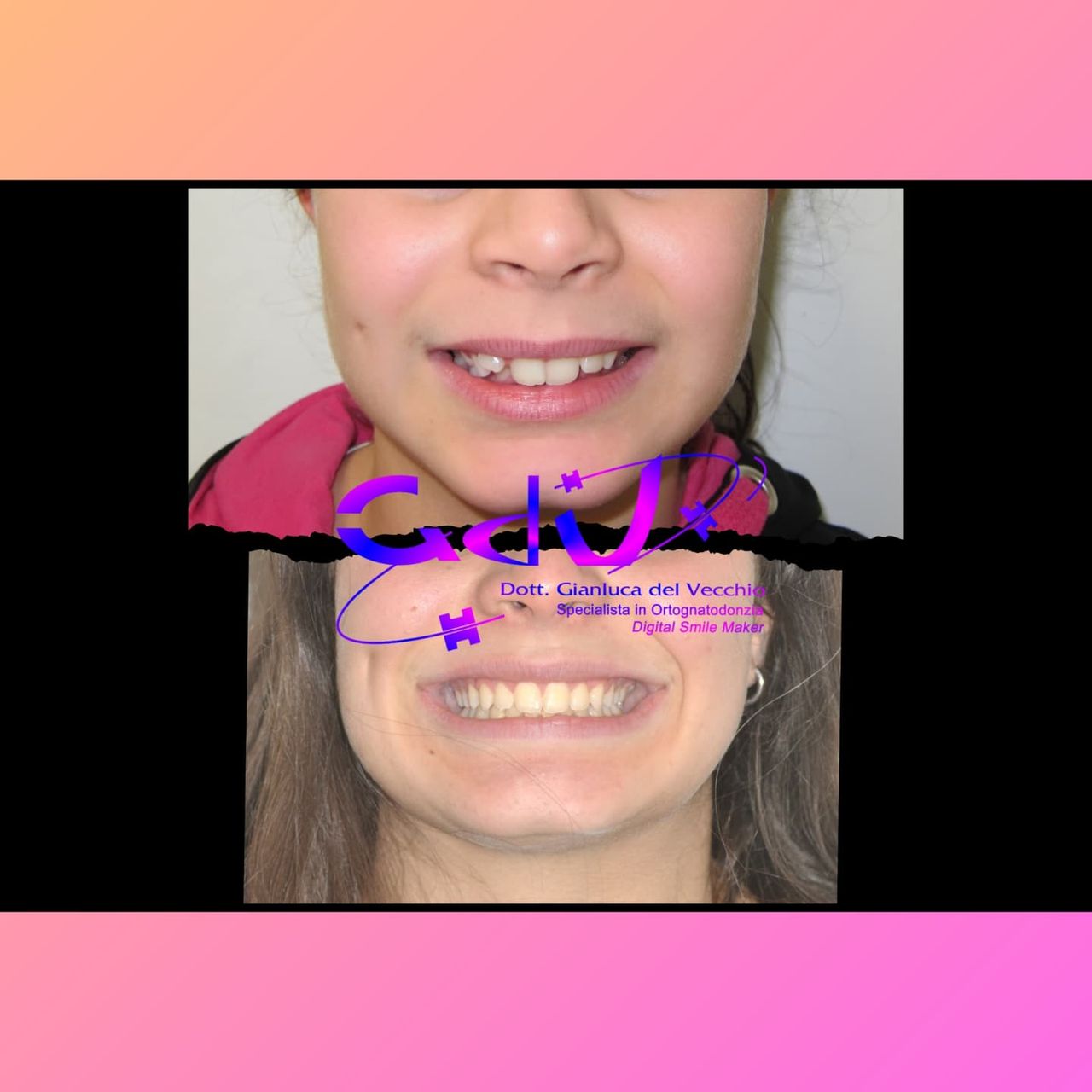 Gianluca Del Vecchio-159