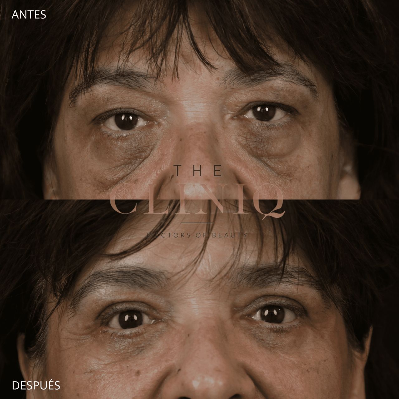 Ignacio Genol Saavedra-9