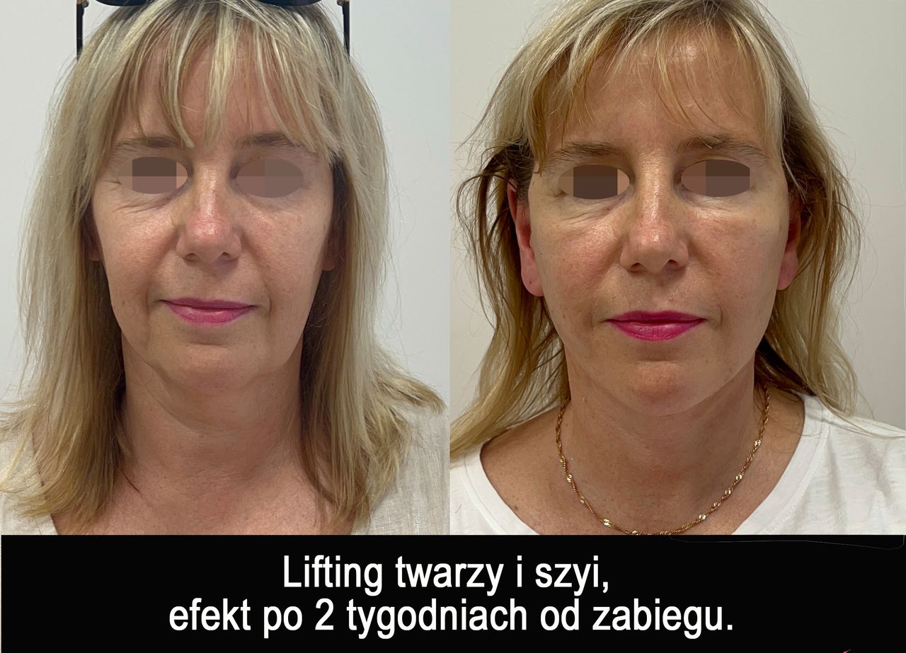 Mariusz Zagajewski-40