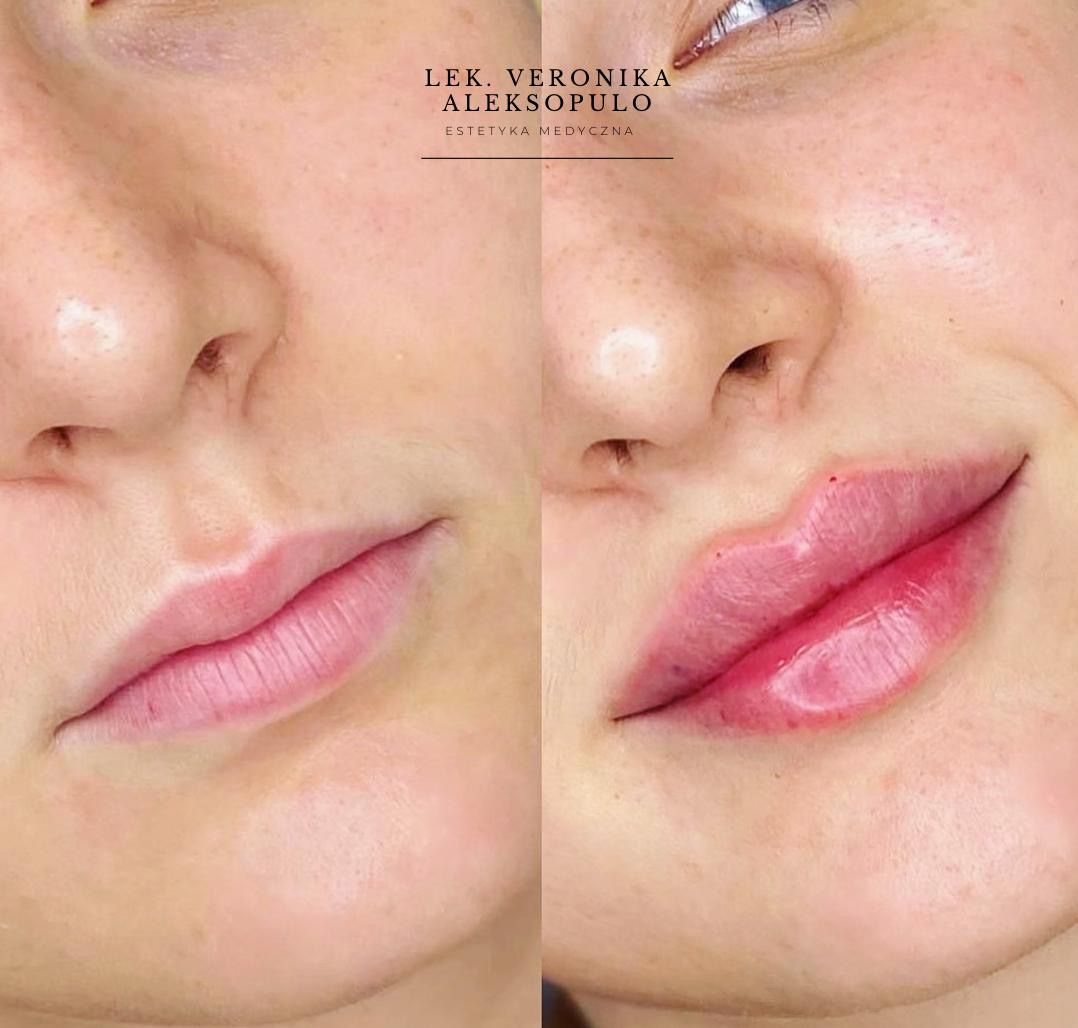 Veronika Aleksopulo-5