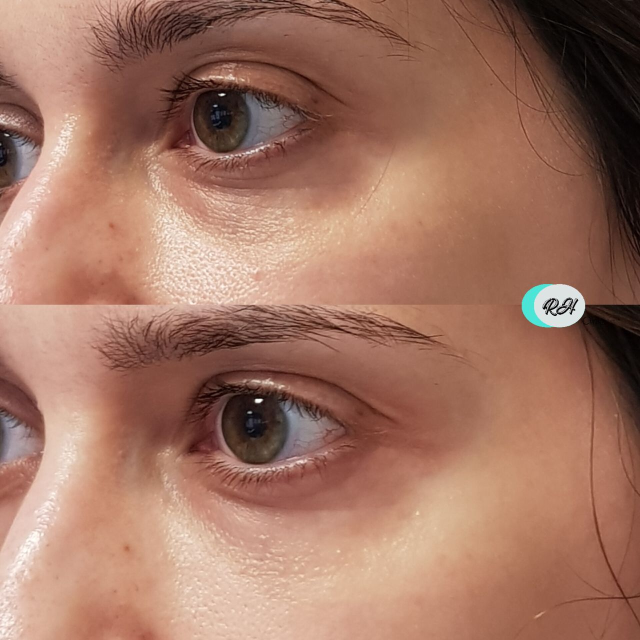 Rosalba Herrero Zerpa-609