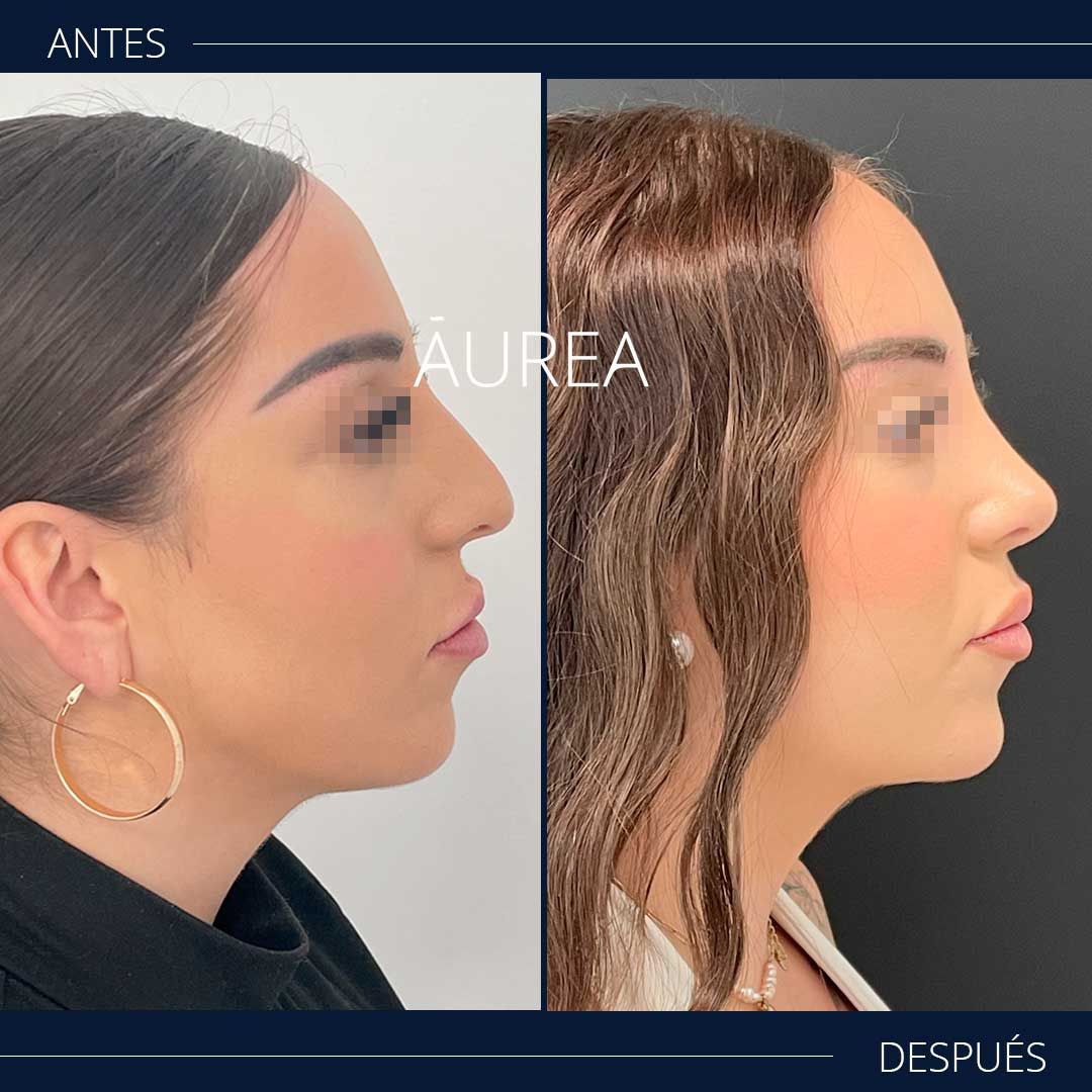 Ana Martínez Padilla-1