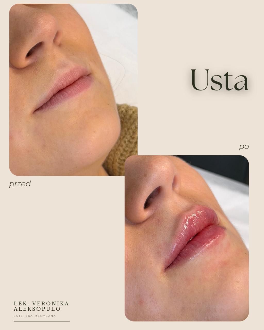 Veronika Aleksopulo-4