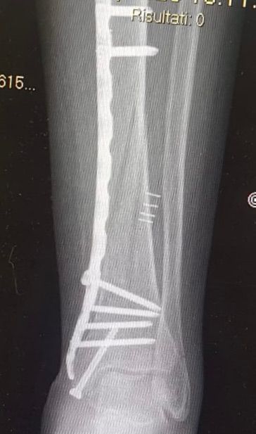 Francesco Palummieri-1