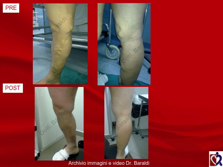 Christian Baraldi-15