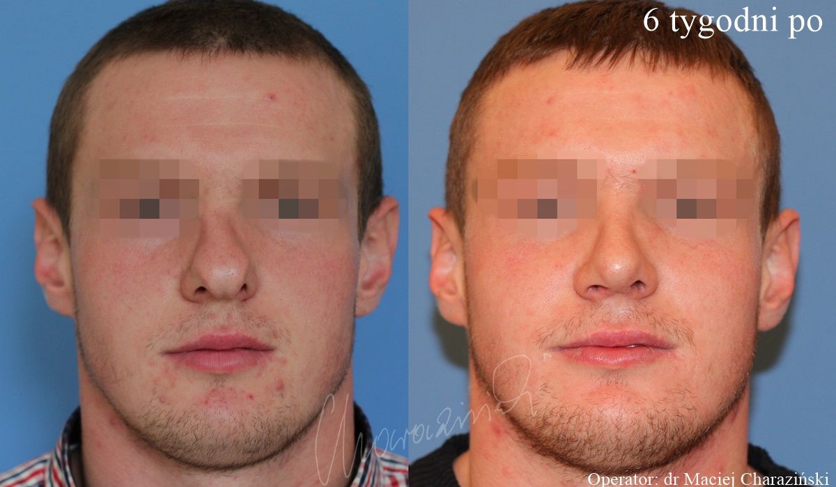 Maciej Charaziński-46