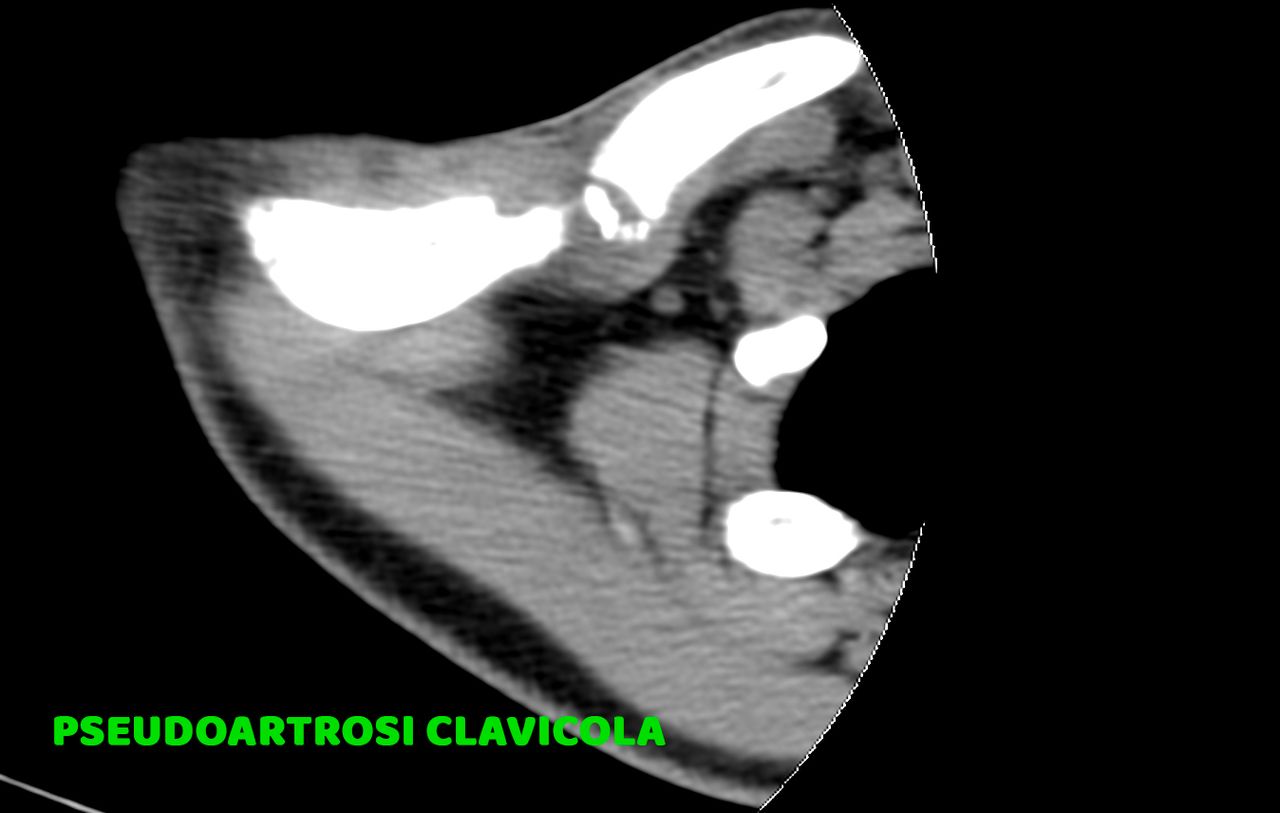 Davide Corrado Vaccarisi-7