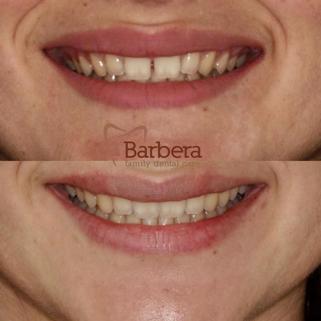 Chiara Barbera-23