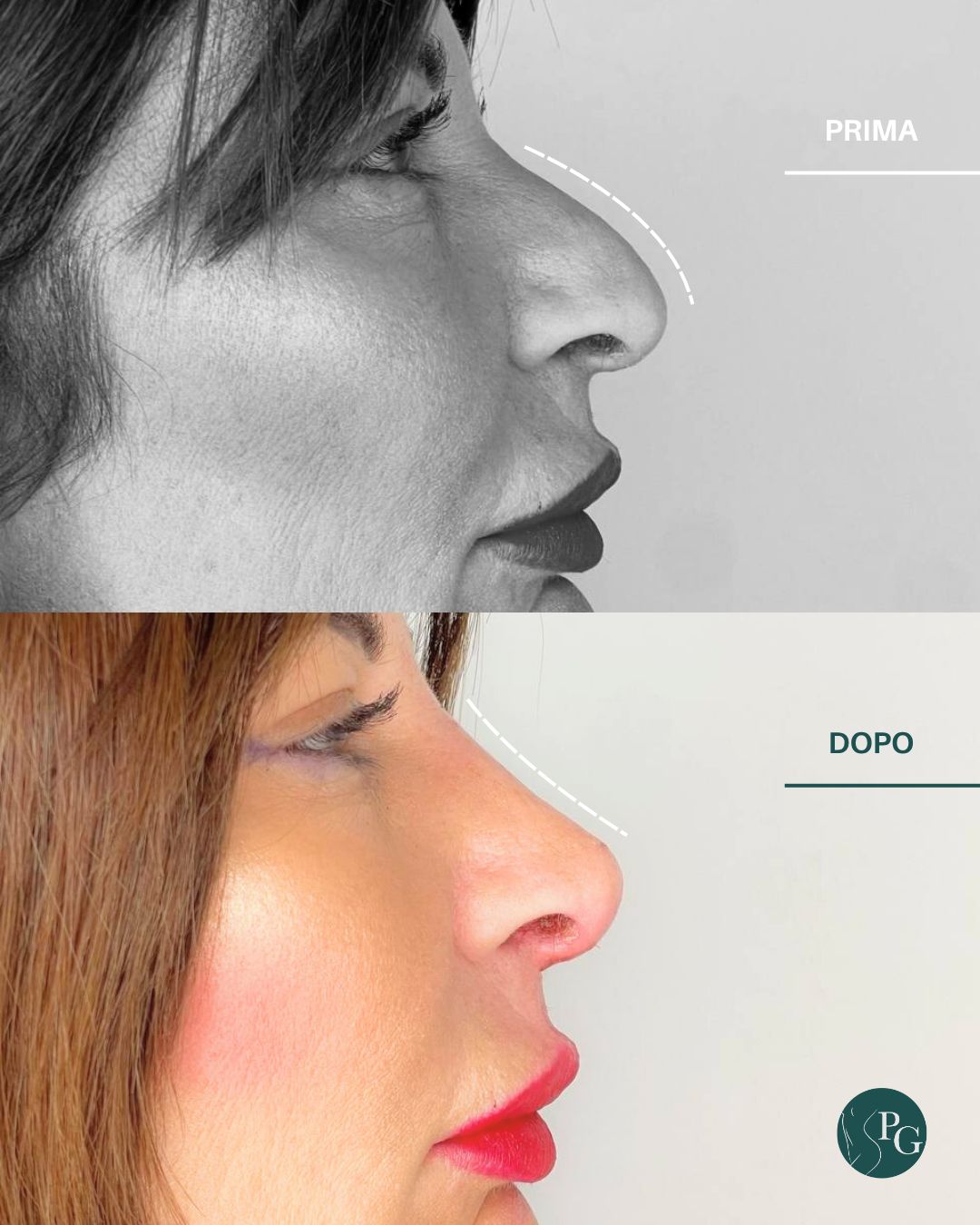 Pasquale Graziano-16