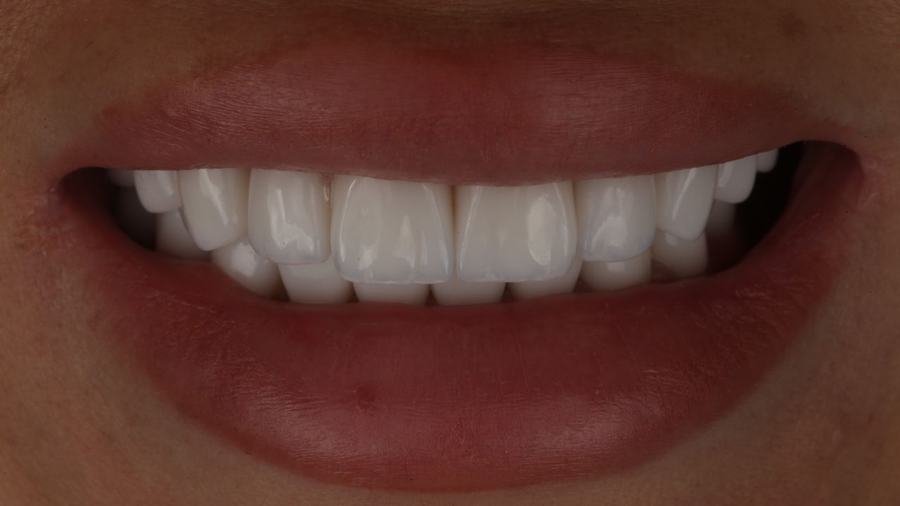 Andrii Shelefontiuk-0