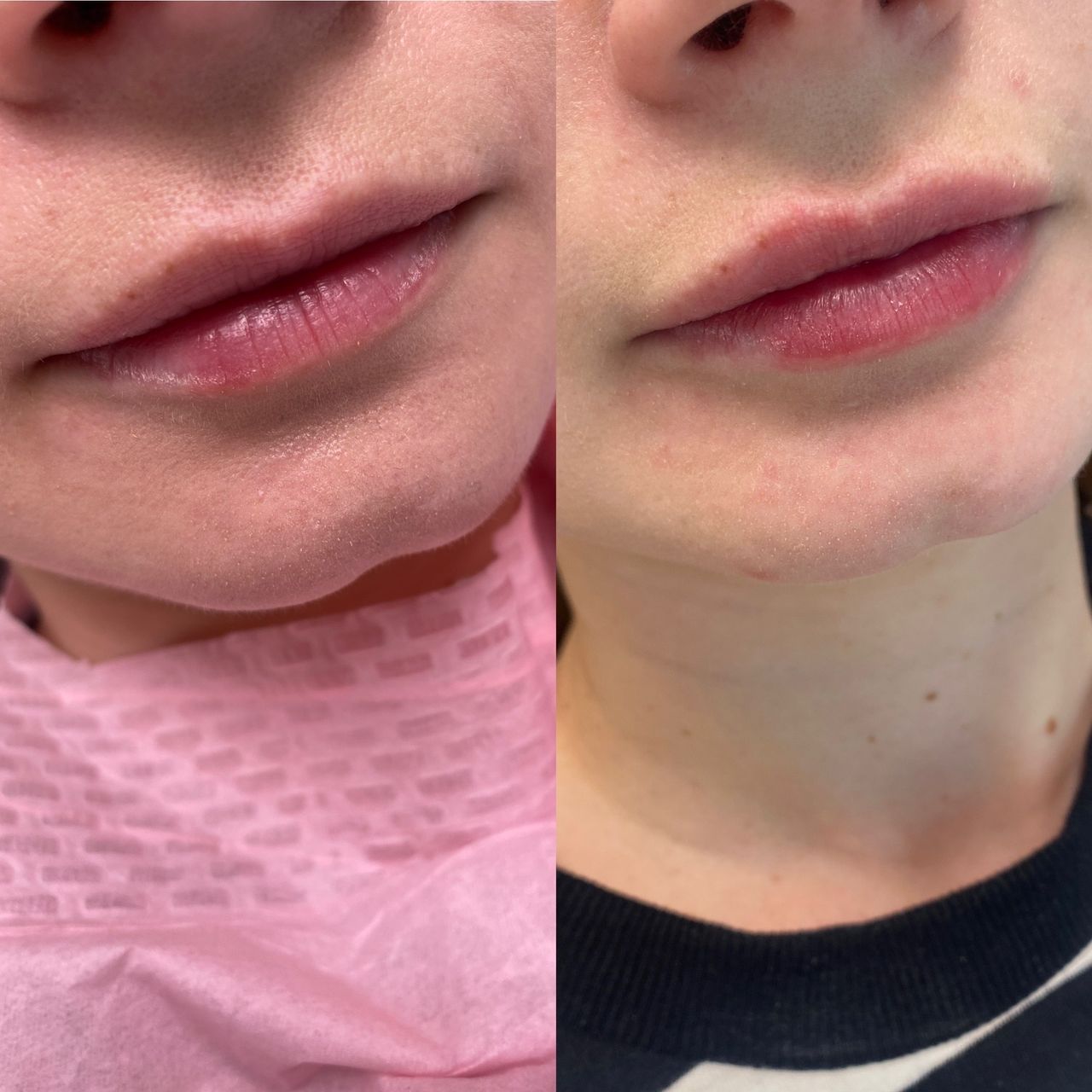 Angelika Świątkowska-35