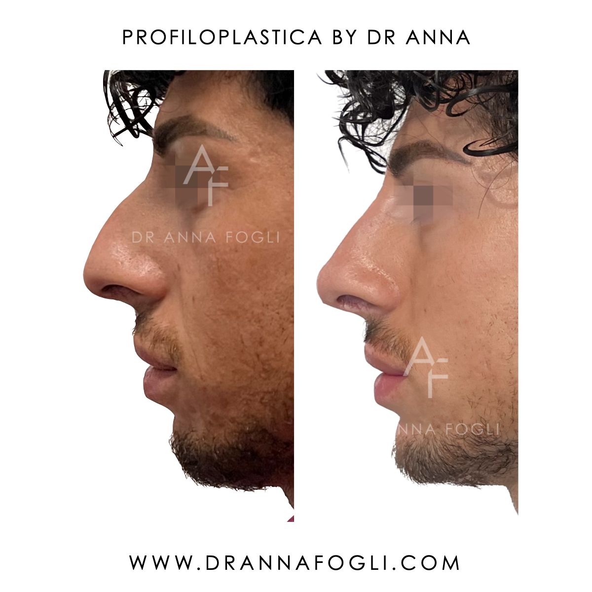 Anna Fogli-3