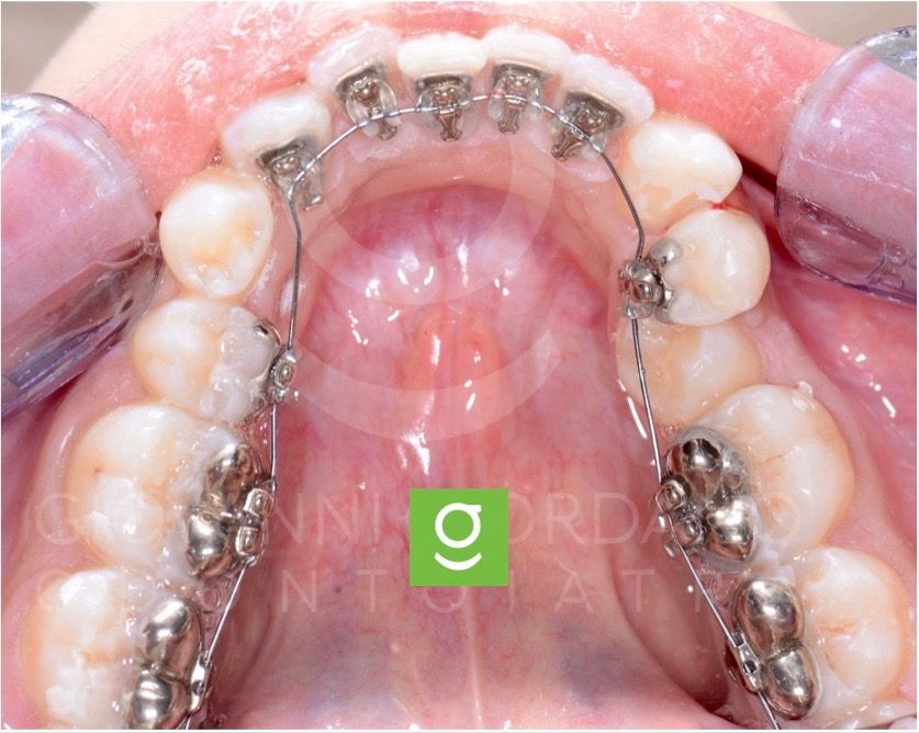 Giovanni Giordano-15