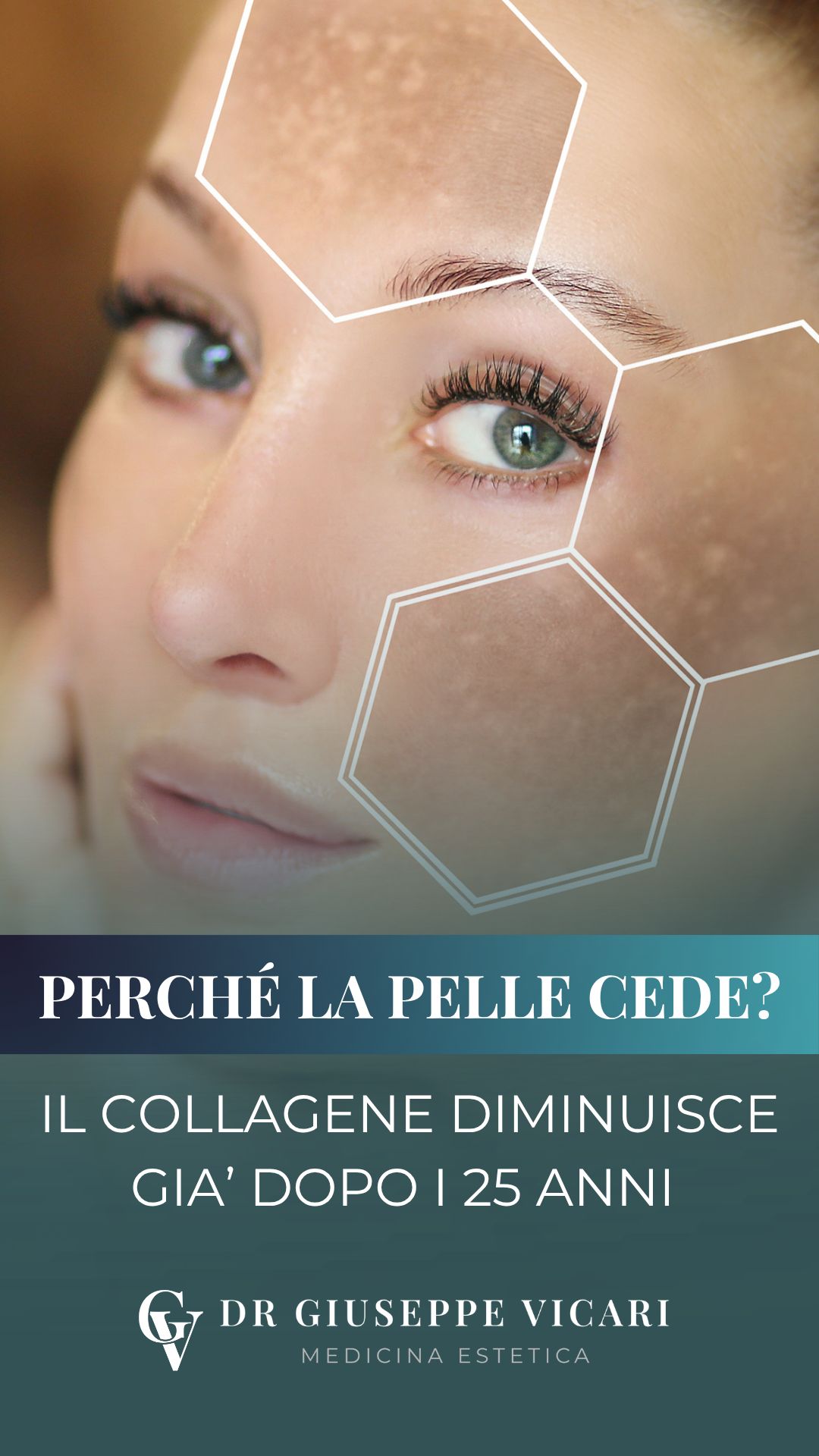 Giuseppe Vicari-9