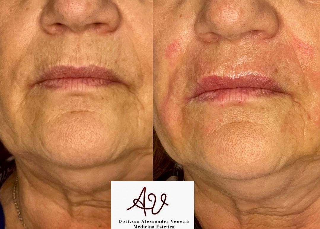 Alessandra Venezia-38