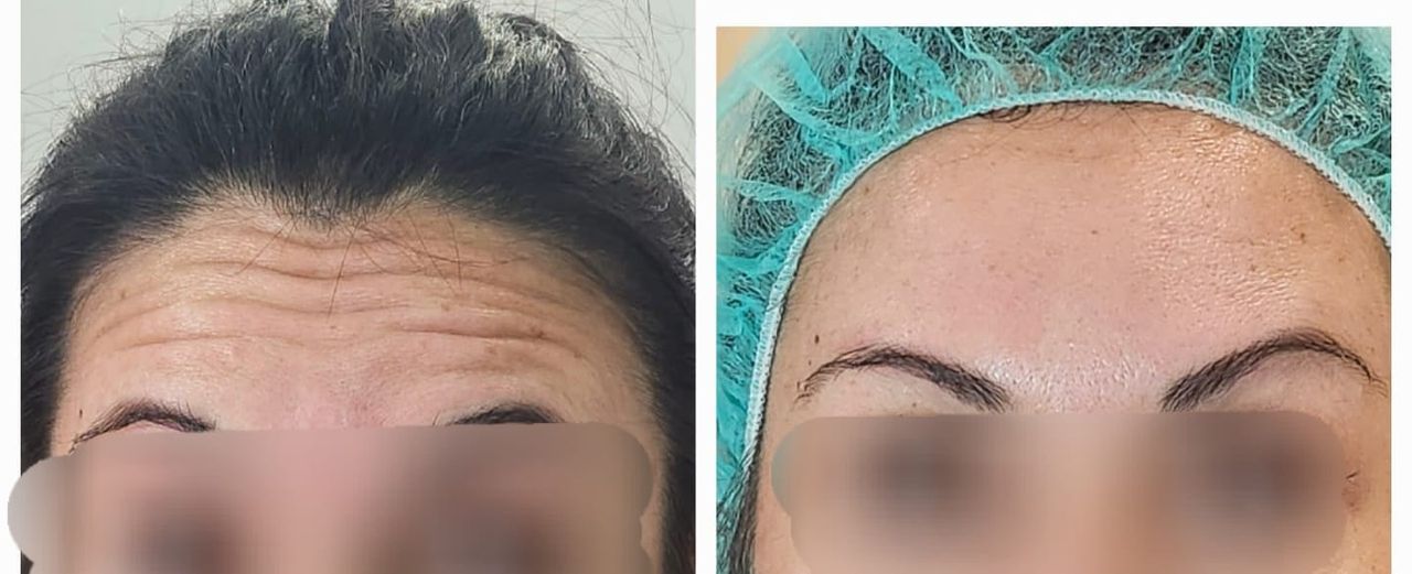 Araceli Reyes Torres-7